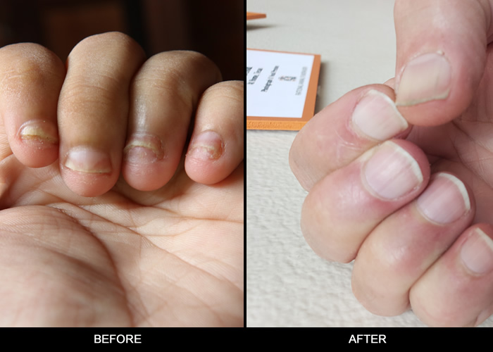 Before and after session
